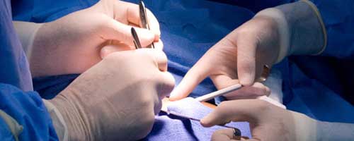 Laparoscopic Surgery